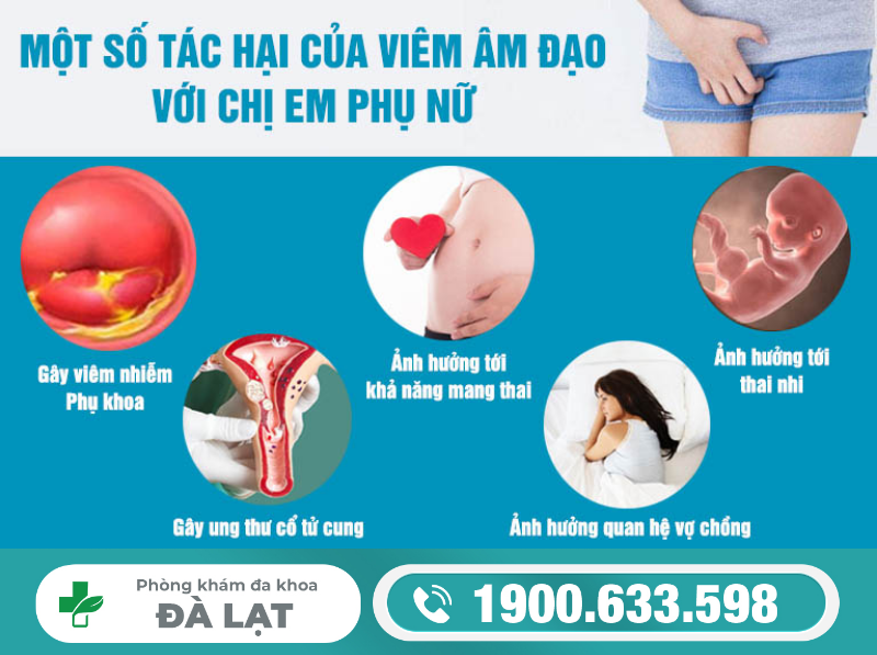 Hình ảnh minh họa